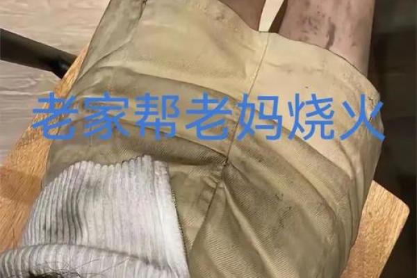 八字烫伤案例：交战必应灾