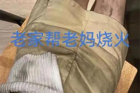 八字烫伤案例：交战必应灾