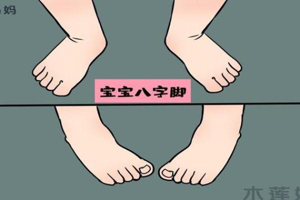 宝宝学走路外八字