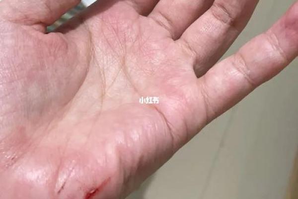 开车摔跤了还能去算命吗