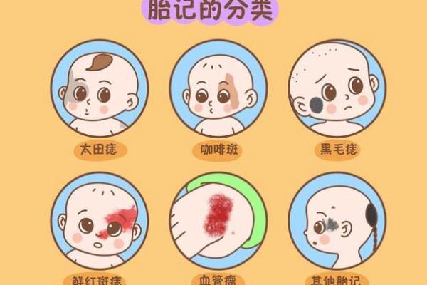 看脸上胎记算命知命运