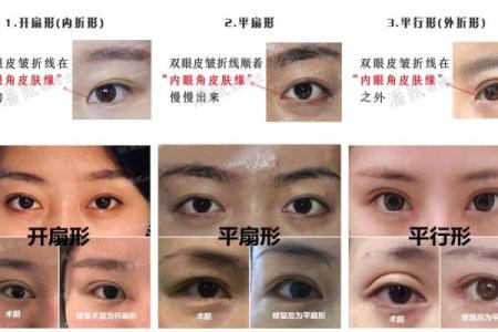 割双眼皮忌讳什么风水