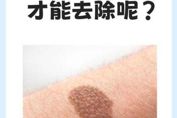 胎记算命：最好胎记长什么部位