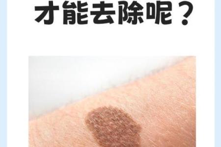 胎记算命：最好胎记长什么部位