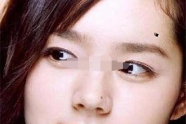 风水上女人有额头痣的特征