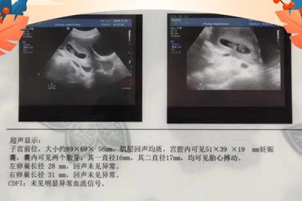 紫薇斗数怀孕迹象