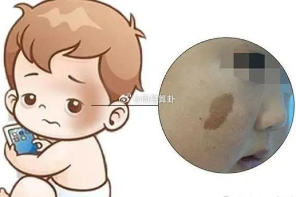 胎记的位置与算命图解 胎记的位置与算命图解
