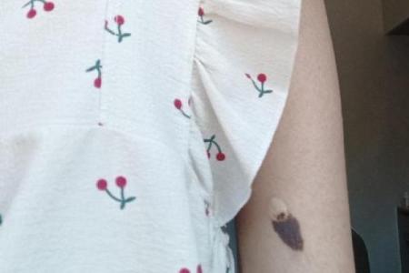 胳膊胎记可以算命吗-