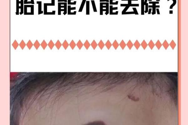 男婴眉心长“月牙”胎记，母亲带他算命后神秘失踪，至今下落不明
