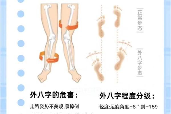 外八字轮 外八字轮