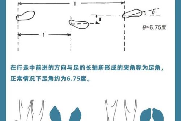 婴儿八字腿 婴儿八字腿