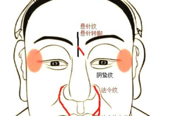 男人印堂八字纹的事业运好吗