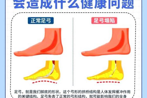 如何纠正内八字脚 如何纠正内八字脚