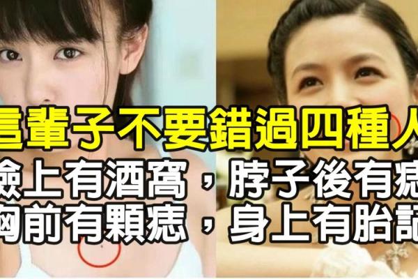 脖子上的胎记如何算命-