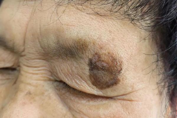 八字胡斑 八字胡斑