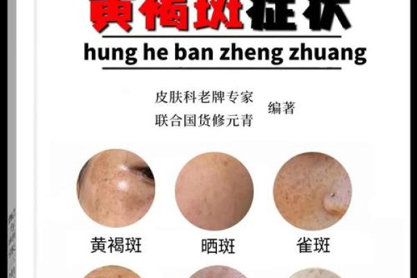 八字胡斑 八字胡斑