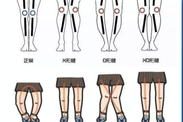 内八字好吗 内八字好吗